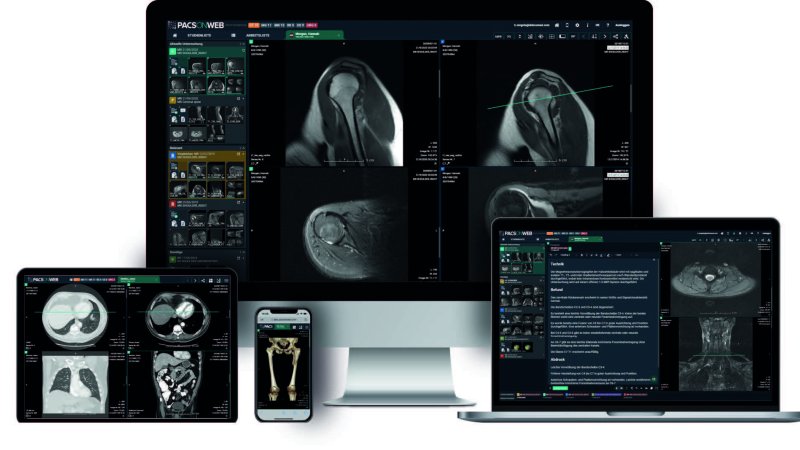 PACSonWEB Multi-Device, auf mehreren Geräten zugreifbar